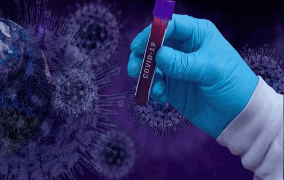 JUČE PREMINULE TRI OSOBE: Zvanično 466 novih slučajeva koronavirusa